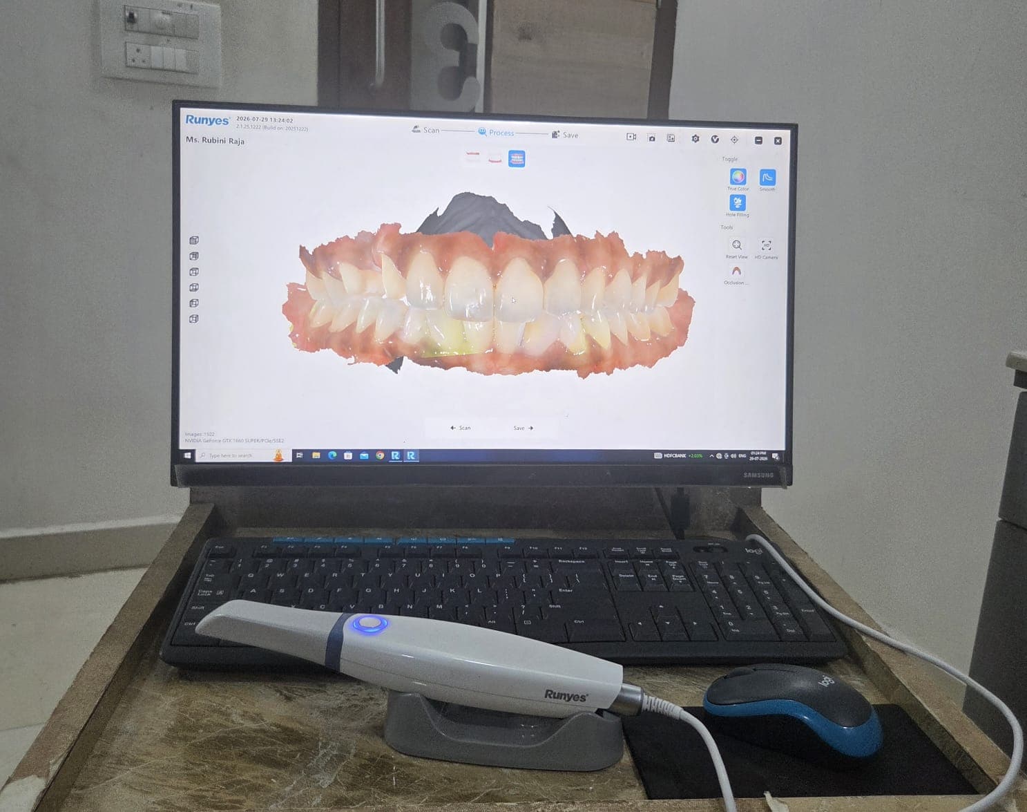 Intra-oral Scanner